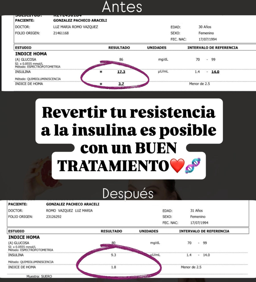 Antes y después