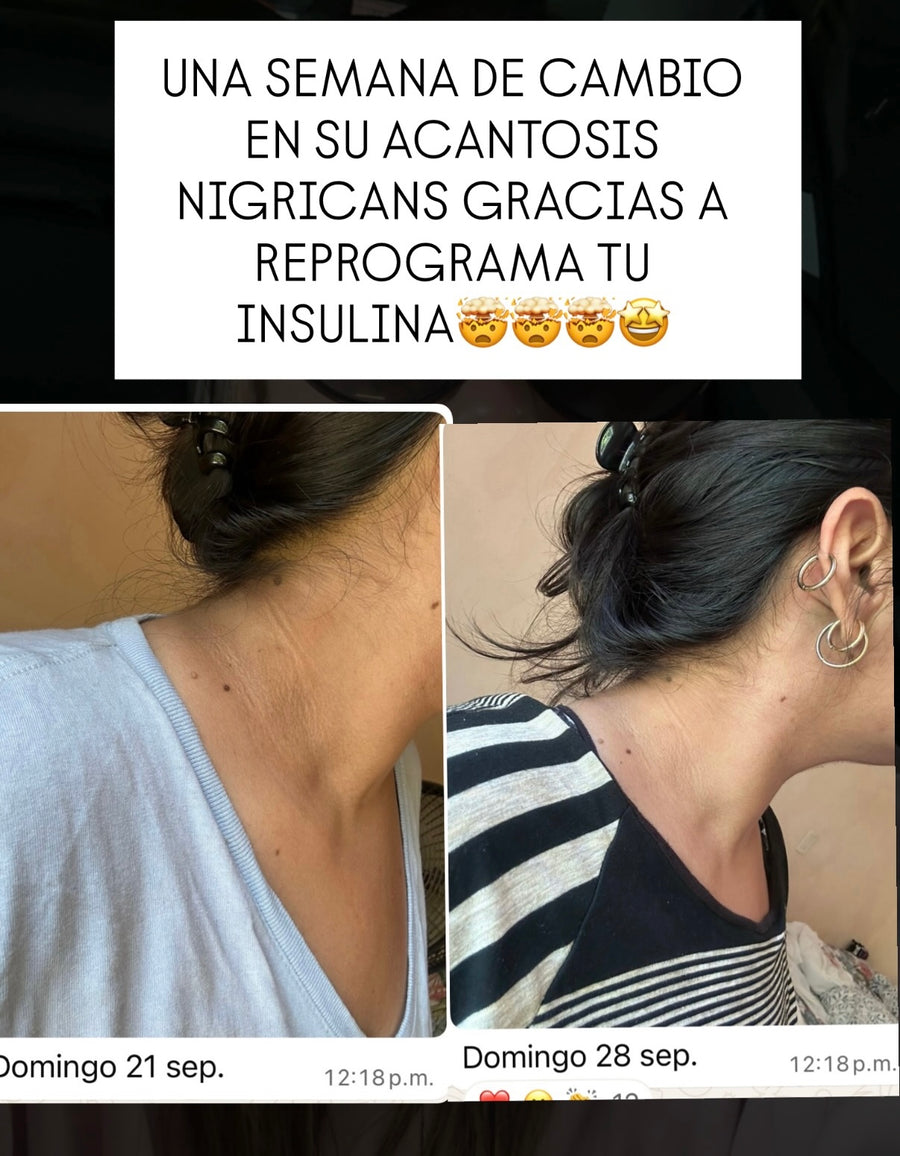 Antes y después